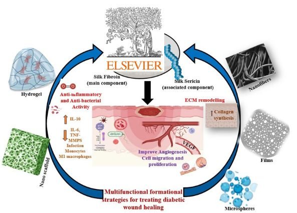 Innovative Silk-Based Biomaterials for Diabetic Wound Healing
